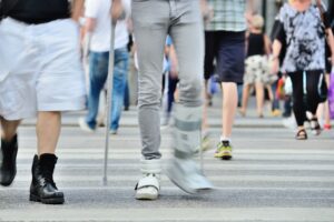 Image of a man walking with a limp